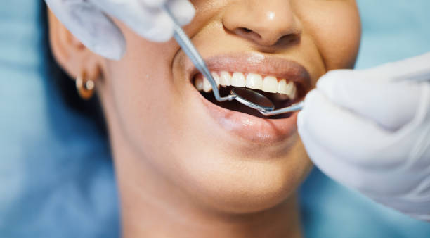 Best Walk-In Emergency Dental Services in Downers Grove, IL